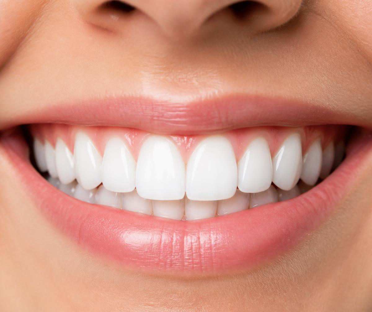 Smile after cosmetic treatment